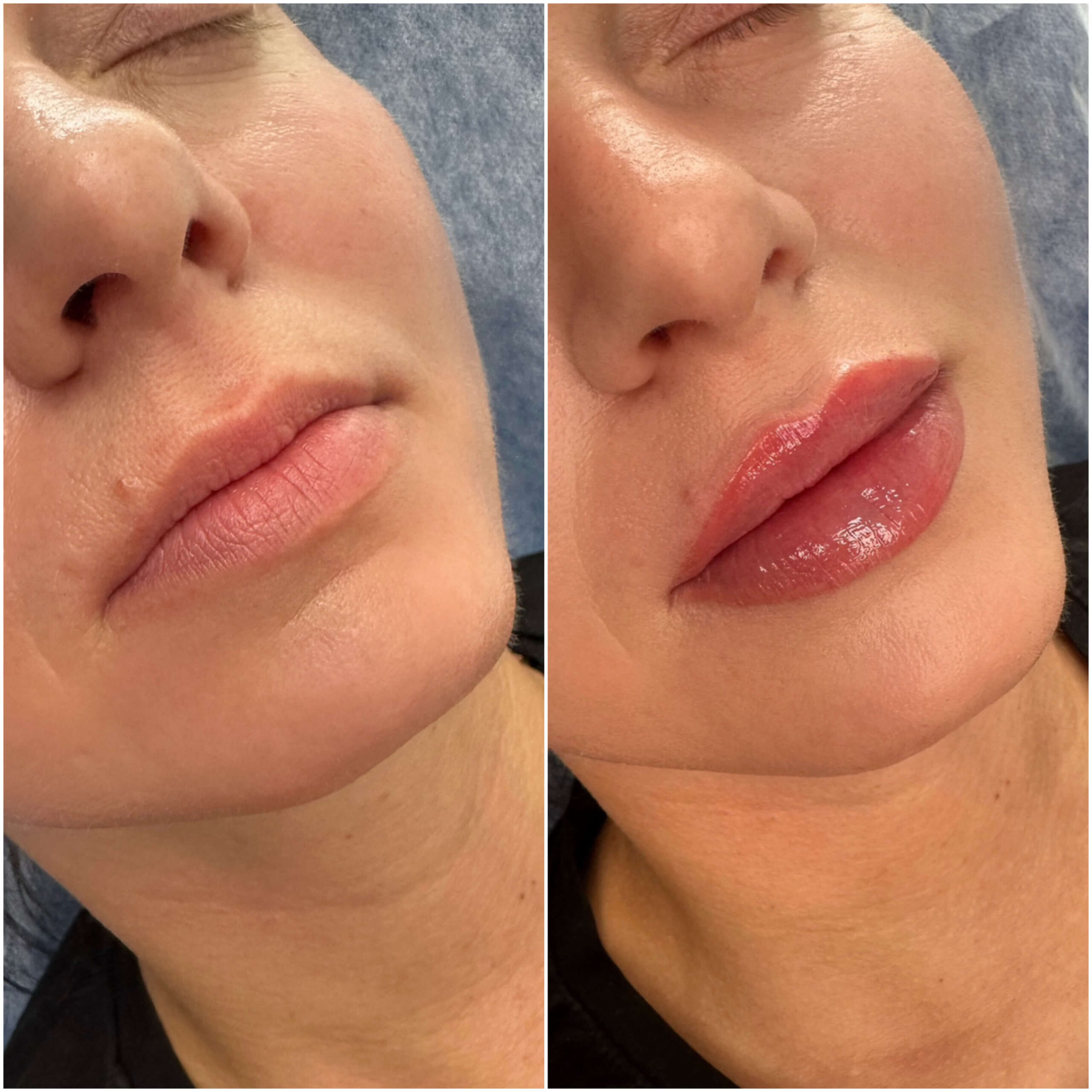 Modelowanie ust przed i po