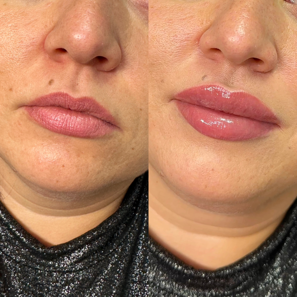 Naturalne efekty modelowania ust